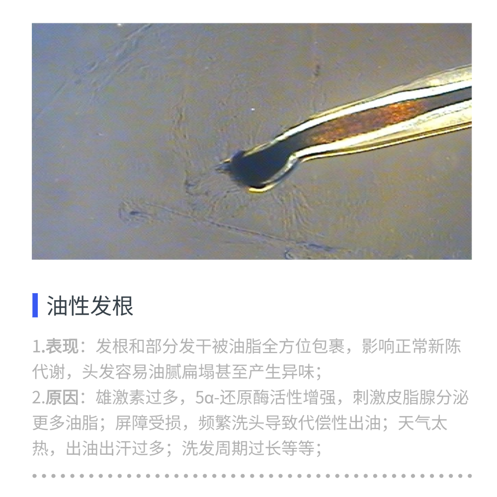 头皮也怕