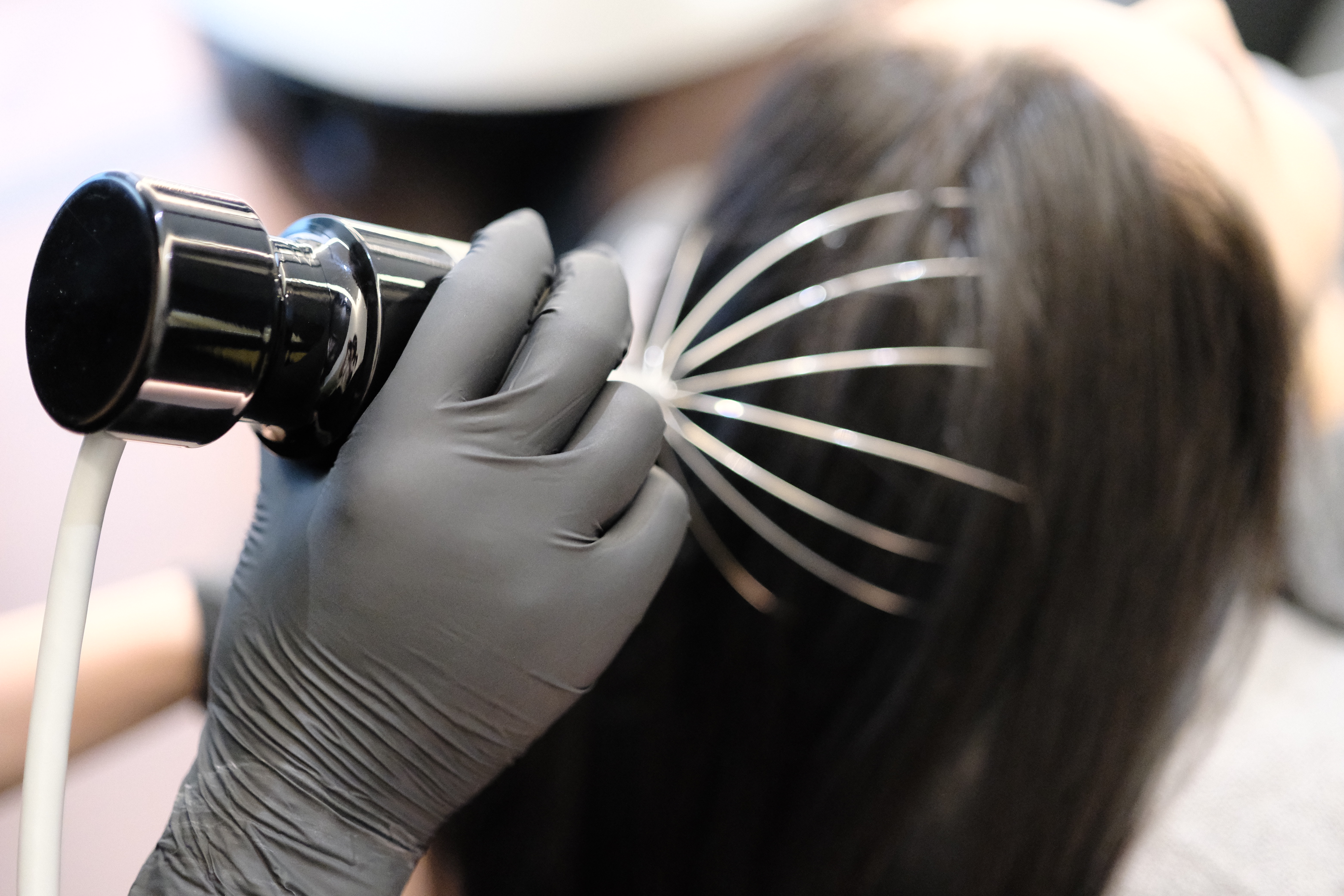 医生提醒：显年轻的人，头皮都有这些特征